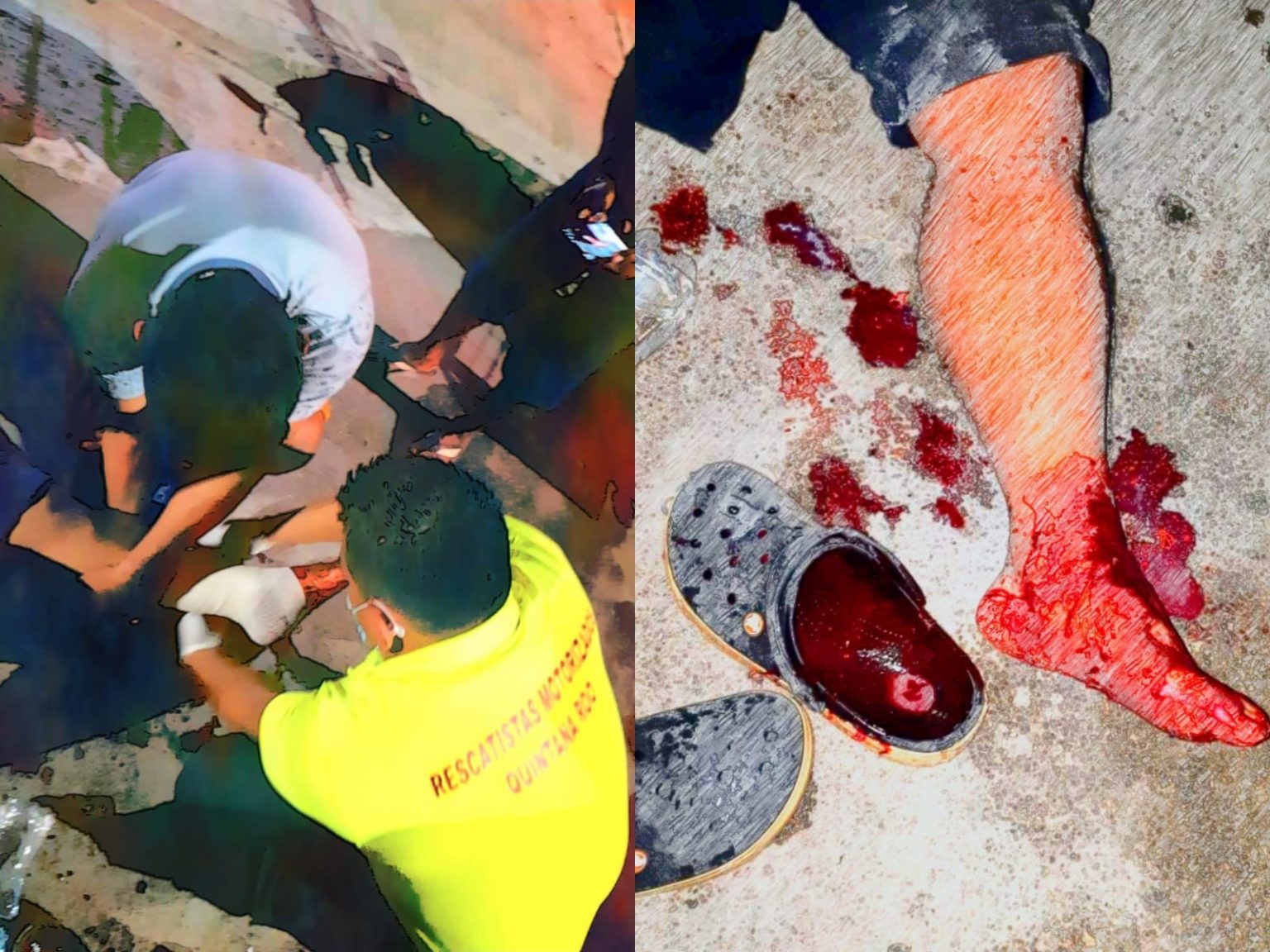 AUTOFANTASMA EN EL EJIDO|| Atropella a motociclista y lo deja ensangrentado