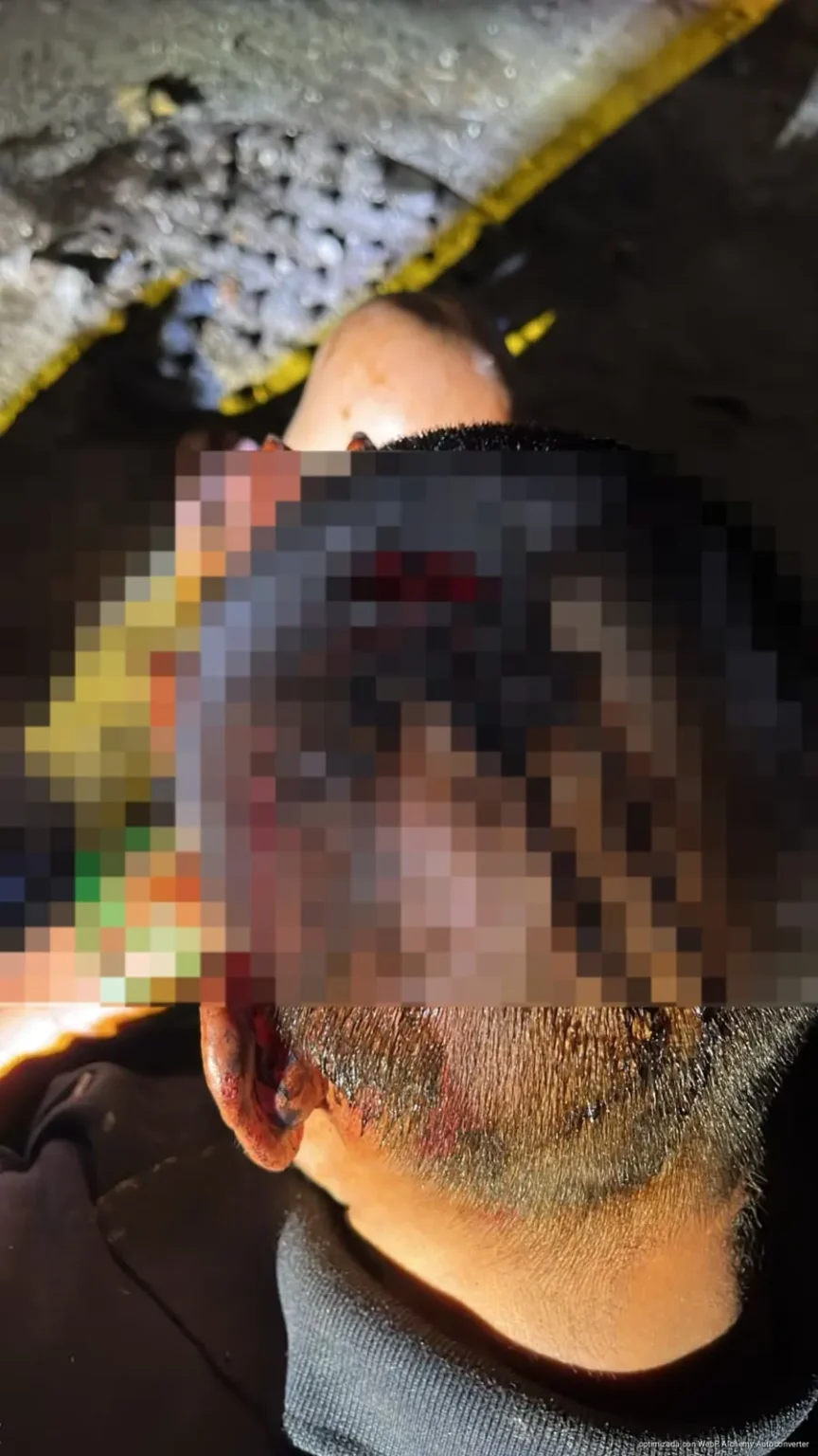 Vecinos someten a presunto ladrón en Villas Otoch Paraíso Vecinos someten a presunto ladrón en Villas Otoch Paraíso